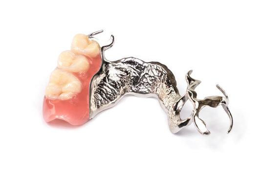 歯科サンプル　金属床義歯　模型付き　歯科医院 歯科サンプル 金属床義歯 模型付き 歯科医院｜歯科サンプル金属床義歯模型